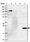 Oleoyl-ACP Hydrolase antibody, NBP1-83779, Novus Biologicals, Western Blot image 