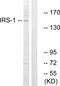 Insulin Receptor Substrate 1 antibody, LS-C118153, Lifespan Biosciences, Western Blot image 