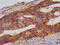 WD Repeat Domain 37 antibody, CSB-PA805557LA01MO, Cusabio, Immunohistochemistry paraffin image 