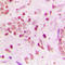 Zinc Finger Protein 608 antibody, LS-C356172, Lifespan Biosciences, Immunohistochemistry paraffin image 