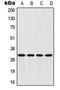 Four And A Half LIM Domains 2 antibody, LS-C352197, Lifespan Biosciences, Western Blot image 