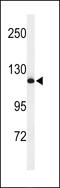 NEDD4 E3 Ubiquitin Protein Ligase antibody, 64-194, ProSci, Western Blot image 