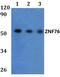 Zinc Finger Protein 76 antibody, PA5-75844, Invitrogen Antibodies, Western Blot image 