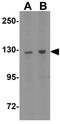 Zinc Finger Protein 687 antibody, GTX32073, GeneTex, Western Blot image 