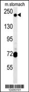 GRIP And Coiled-Coil Domain Containing 2 antibody, MBS9210728, MyBioSource, Western Blot image 