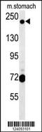 GRIP And Coiled-Coil Domain Containing 2 antibody, MBS9210728, MyBioSource, Western Blot image 