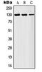 AF4/FMR2 Family Member 1 antibody, LS-C354031, Lifespan Biosciences, Western Blot image 