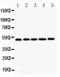 Nuclear Receptor Subfamily 1 Group H Member 3 antibody, PA1246-1, Boster Biological Technology, Western Blot image 