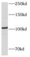 Adenosine Monophosphate Deaminase 2 antibody, FNab00371, FineTest, Western Blot image 