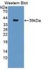 Insulin Receptor antibody, abx131774, Abbexa, Western Blot image 