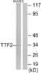 Forkhead Box E1 antibody, abx013267, Abbexa, Western Blot image 