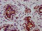 Eukaryotic Translation Initiation Factor 2 Subunit Alpha antibody, CSB-RA007523A51phHU, Cusabio, Immunohistochemistry paraffin image 