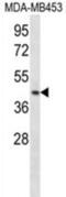 Ring Finger Protein 1 antibody, abx028143, Abbexa, Western Blot image 