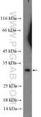 Ring Finger Protein 144B antibody, 26306-1-AP, Proteintech Group, Western Blot image 