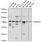 Sodium Channel Epithelial 1 Delta Subunit antibody, 13-524, ProSci, Western Blot image 