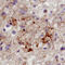 G Protein-Coupled Receptor Kinase 2 antibody, AF4339, R&D Systems, Immunohistochemistry paraffin image 