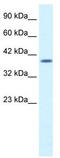 Proteasome 26S Subunit, Non-ATPase 14 antibody, TA330547, Origene, Western Blot image 