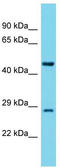 Tyrosyl-TRNA Synthetase 2 antibody, TA332274, Origene, Western Blot image 