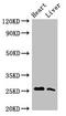 Troponin I3, Cardiac Type antibody, LS-C681869, Lifespan Biosciences, Western Blot image 