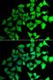 Transaldolase 1 antibody, LS-C335703, Lifespan Biosciences, Immunofluorescence image 