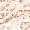 Dispatched RND Transporter Family Member 3 antibody, A11929-1, Boster Biological Technology, Immunohistochemistry paraffin image 