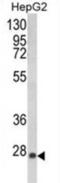 Glutathione S-Transferase Alpha 1 antibody, abx034069, Abbexa, Western Blot image 