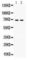 Involucrin antibody, PB9712, Boster Biological Technology, Western Blot image 