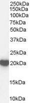 Casein Kinase 1 Delta antibody, 45-362, ProSci, Immunofluorescence image 