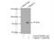 Calpain-6 antibody, 10120-1-AP, Proteintech Group, Immunoprecipitation image 