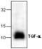 Transforming Growth Factor Alpha antibody, GTX59851, GeneTex, Western Blot image 