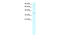 Stearoyl-CoA Desaturase antibody, 27-711, ProSci, Western Blot image 