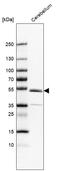Zinc Finger Protein 692 antibody, HPA059337, Atlas Antibodies, Western Blot image 