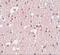 FERM And PDZ Domain Containing 3 antibody, A18423, Boster Biological Technology, Immunohistochemistry frozen image 