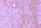 C-C Motif Chemokine Receptor 8 antibody, GTX21666, GeneTex, Immunohistochemistry paraffin image 