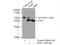 BMI1 Proto-Oncogene, Polycomb Ring Finger antibody, 10832-1-AP, Proteintech Group, Immunoprecipitation image 