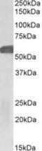 Glucagon-like peptide 1 receptor antibody, MBS423359, MyBioSource, Western Blot image 