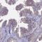 SPARC (Osteonectin), Cwcv And Kazal Like Domains Proteoglycan 2 antibody, NBP1-92442, Novus Biologicals, Immunohistochemistry paraffin image 