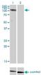 Chloride Voltage-Gated Channel 2 antibody, H00001181-M01, Novus Biologicals, Western Blot image 