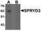 SPRY Domain Containing 3 antibody, TA320061, Origene, Western Blot image 