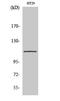 ATPase Sarcoplasmic/Endoplasmic Reticulum Ca2+ Transporting 1 antibody, STJ95618, St John