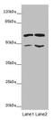 ST3 Beta-Galactoside Alpha-2,3-Sialyltransferase 5 antibody, LS-C676549, Lifespan Biosciences, Western Blot image 