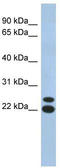 Chromosome 19 Open Reading Frame 54 antibody, TA333369, Origene, Western Blot image 
