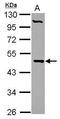 Phosphate Cytidylyltransferase 2, Ethanolamine antibody, GTX104462, GeneTex, Western Blot image 