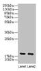 Ubiquitin Conjugating Enzyme E2 I antibody, LS-C210958, Lifespan Biosciences, Western Blot image 