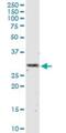 Interferon Alpha 2 antibody, H00003440-M07, Novus Biologicals, Western Blot image 