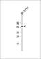 Iroquois-class homeodomain protein IRX-3 antibody, MBS9213261, MyBioSource, Western Blot image 