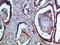 Fas Ligand antibody, STJ99000, St John