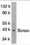 C-X-C Motif Chemokine Receptor 6 antibody, 1170, ProSci, Western Blot image 