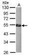 Krueppel-like factor 17 antibody, NBP2-17069, Novus Biologicals, Western Blot image 