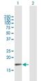 Protein Phosphatase 3 Regulatory Subunit B, Beta antibody, H00005535-B01P, Novus Biologicals, Western Blot image 